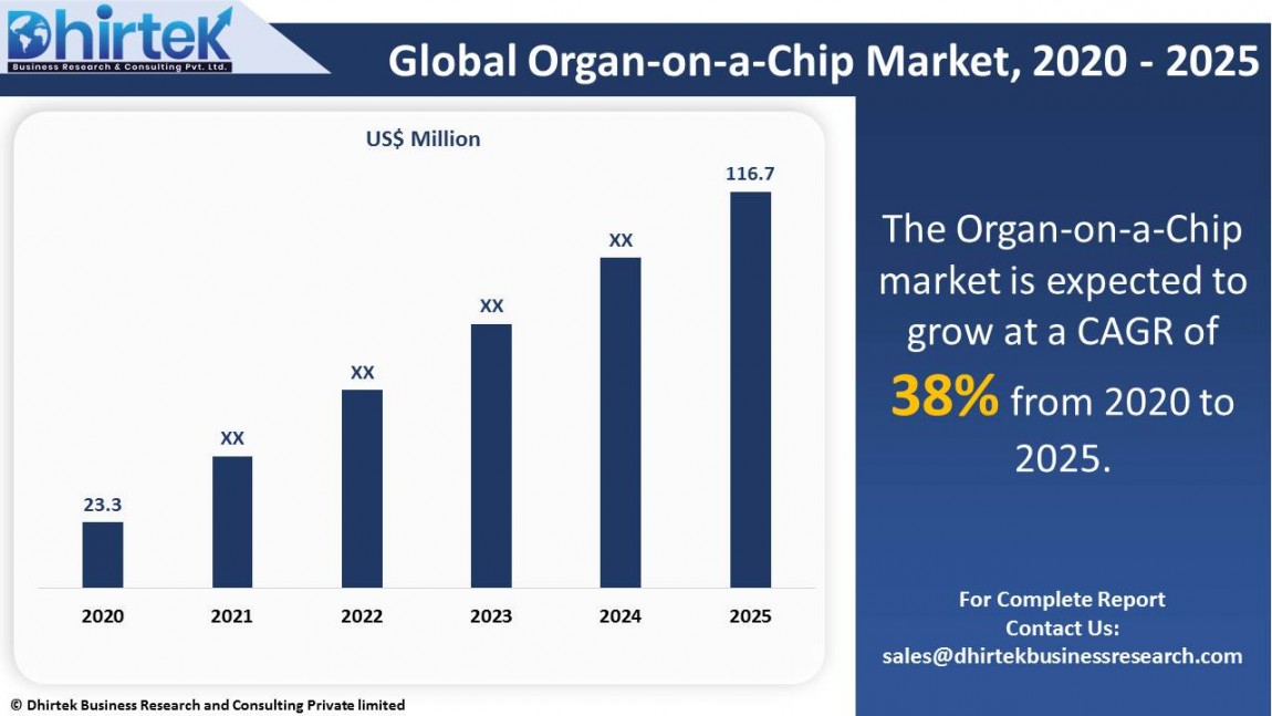 Organ on a Chip Market